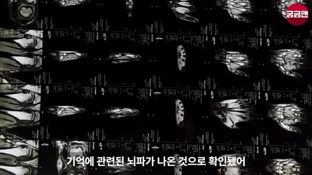 뇌전증 환자의 뇌파 연구